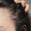 2244 | 두피열내리는법 강력 추천 수시로 뿌리는 예얼 두피 에센스