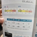 나눔의원 | 라섹 일주일 후기 | 밝음나눔안과의원 | 투데이라섹