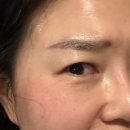 와티 | 와티 포 스킨 글루타치온 NMN 마이크로 스피큘 랩핑 마스크 솔직히 후기