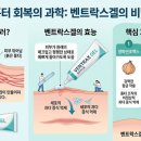 벤트락스겔 성분 및 부작용, 약국 흉터 연고 완벽 정리 5분 컷