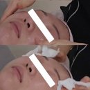 부산 양정 여드름 피부 관리 다일라 에스테틱 솔직 후기