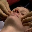 Zygoma Release 이미지