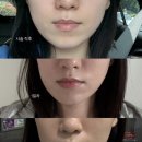 바노바기 창원 세르프 가격 등 솔직후기