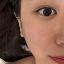 월곶풍림1차후문상가 | 월곶 피부관리 유앤율뷰티 스킨플래닝 솔직후기