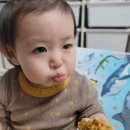 아기 이마 찢어진 후 꿰맨 후 약 두달후 상처부위 공유
