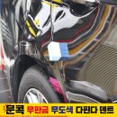 덴트핀다 이미지