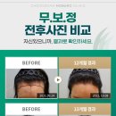 헤어온의원 이미지
