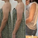 웨딩트리엔골든트리 | 포항팔슬리밍 받고 충격... 몇 년째 딱딱했던 팔뚝이 말랑해졌어요 (+2일차 변화)