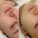 마루비엔비엔 | 청주피부관리 청주웨딩관리 전문점 스파나인 지웰점에서 비엔서ldm 관리 받은 후기