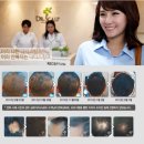 닥터스칼프 신촌점 | <뷰티파우더룸> 탈모두피관리 전문치료센터★닥터스칼프 신촌점 방문 후기