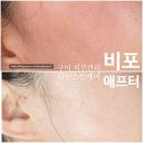 형곡로1L-1 | 구미 피부관리 후회없을 형곡동 피부관리 다인스킨케어