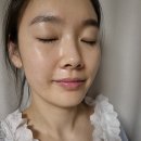 중리행복길 특화거리 | 이천피부맛집 :: 뷰티더연 어븀야그 프락셔널 체험기 (내돈내산 솔직 후기)