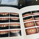 하나큐치과의원 | 고민 끝에 다녀온 인생 첫! 강남치과 루시네이트 상담 후기