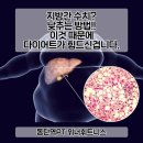 지방간의 진단과 관리 | 지방간 알고계신가요?! 동탄역PT 유민
