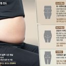 다 같은 뱃살 아냐.. '이런 모양'일 때 가장 위험 이미지