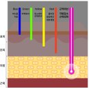 광뷰티 의료기기 이미지
