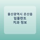 킴플란트치과의원 | 울산광역시 온산읍 임플란트 평균 가격과 후기 정리