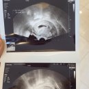 김숙희산부인과의원 네이버블로그