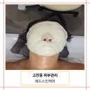 레드스킨케어 - 수원시 장안구 | 안산 고잔동 피부관리 레드스킨케어 줄기세포 앰플 워터매직 관리 후기