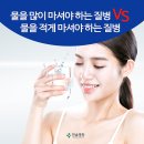 물을 많이 마셔야하는 질병 VS 물을 적게 마셔야 하는 질병 이미지