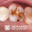 서울에스(S)퍼스트치과의원 이미지