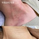 유일콜드 이미지