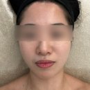 무드포미 | 예비신부관리 추천 서울 홍대 웨딩관리 리프팅 체형관리 포미 FORMI 솔직후기