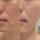 스텔라바디핏 | 광안리에스테틱 스킨핏헤드스파&에스테틱