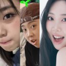 "이영지 맞아?" 4년 고민 끝 눈밑지 성형 전후.. 쿨하게 밝힌 '마지막 성형' 소신 (ft. 비용/후기)