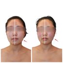 동양인삼약초 | 턱비대칭 관리로 방문한 강동피부관리 정형뷰티어겐 방문 후기