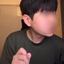 인링크 | [피부시술] 인링크(인모드+슈링크) 3회차 후기