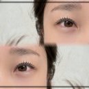 YU 뷰티샵 | 울산 신정동에서의 특별한 경험, 산뜻뷰티의 스킨플래닝 후기