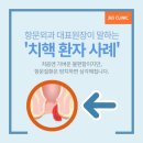 365항외과의원 | 번동항문외과 변비인 줄 알았는데 치핵4기