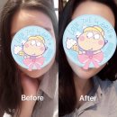 씨스투(CS2)에스테틱 | 강서구피부 에스테틱 채운뷰티 에서 CS2 스팀샤워 관리받고 온 솔직후기