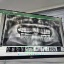 죽파치과 이미지