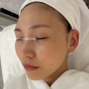 상봉2동 한일써너스빌앞 | 중랑구 피부관리, 망우동 [아이올라] 솔직 후기 : 프리미엄 수분 리프팅으로 광채 충전!