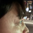 담주한의원 | 천안 피부과 한의원에서 패인흉터치료하기!(천안 새살침)