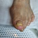 더케이샵 | 구갈 왁싱샵 더케이, 무좀발톱 관리로 방문한 후기