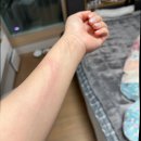 GR(창녕군)-[부곡로]-상-7 | [부산 지동범동물병원] 사랑하는 미소의 백내장 수술기 1탄 (오픈런 웨이팅+검사비용)