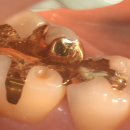 레몬치과의원 이미지