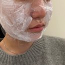 마이스킨피부과의원 | [대구 범어역 피부과] 베러미의원 범어점 스킨보톡스 통증 및 솔직후기