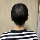 라이크메디칼 | #3 유방암 항암 후 머리 기르는 과정 | 때머리부터 숏컷까지 ٩(๑´0`๑)۶