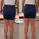 삼일카 | 역삼동필라테스 추천, 통증 케어에 감동했던 카이노필라테스 후기(하체 부종 전•후 사진0)🩷