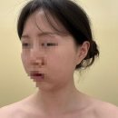 스토리샵 | 천안신불당피부샵 스토리에스테틱 관리후기