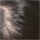 새희망약국 | 미녹시딜 여자 부작용 솔직 후기 (사용 전 필독)