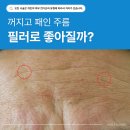 동탄 필러 피부과 (*진료과목) 고민이라면? 필러 원리부터 꼭 알아보세요