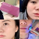 강남대로3-8 | 신논현역피부과에서 쥬브아셀8% 쥬브아셀3% 고민끝에 선택한 피부 변화 후기