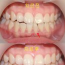 이사랑치과 이미지
