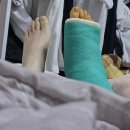 뒹굴개 | 부주상골 인대파열 수술 후기