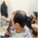 면목동-162 | 동대문구가발 맞춤 제대로 받은 날, 숱 걱정이 싹 사라졌어요~